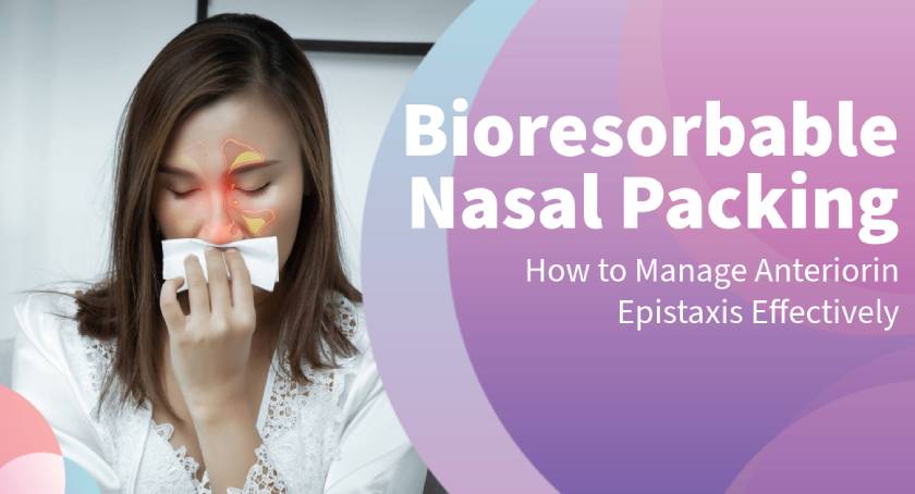 How to Manage Anterior Epistaxis Using Bioresorbable Nasal Packing